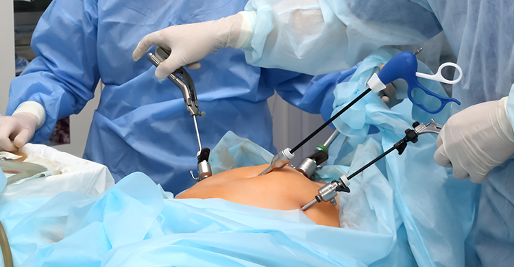 Laparoscopic